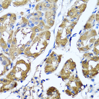 Immunohistochemistry - HYAL1 Polyclonal Antibody 