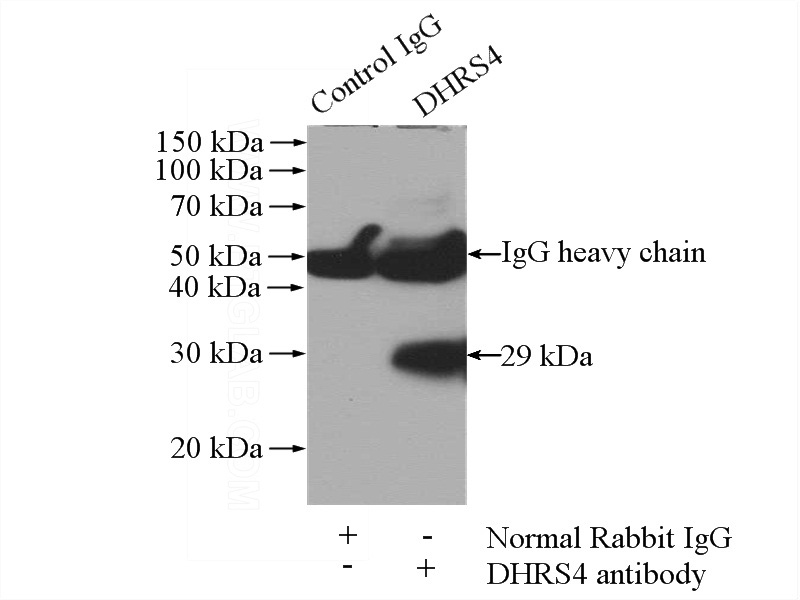 IP Result of anti-DHRS4 (IP:Catalog No:109925, 4ug; Detection:Catalog No:109925 1:400) with mouse liver tissue lysate 4000ug.
