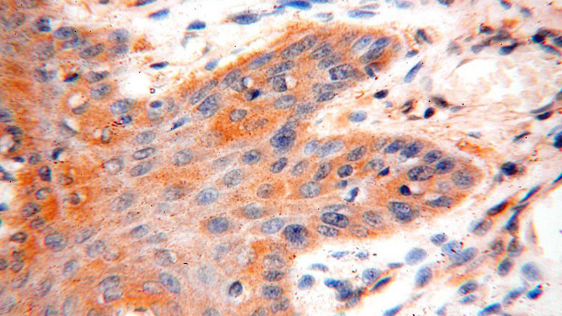 Immunohistochemical of paraffin-embedded human skin using Catalog No:116702(VAC14 antibody) at dilution of 1:100 (under 40x lens)