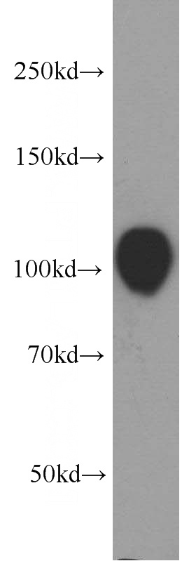 Raji cells were subjected to SDS PAGE followed by western blot with Catalog No:110425(EZH2 antibody) at dilution of 1:1500