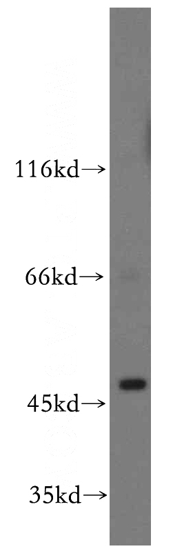 mouse heart tissue were subjected to SDS PAGE followed by western blot with Catalog No:113803(EGLN1 antibody) at dilution of 1:500