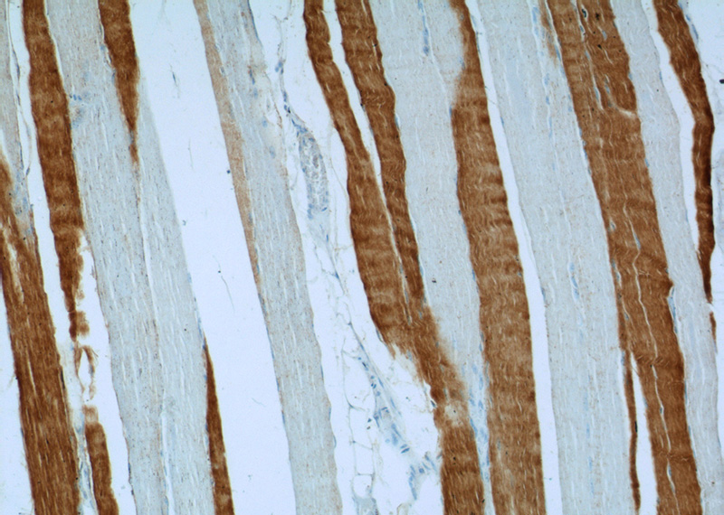 Immunohistochemistry of paraffin-embedded human skeletal muscle tissue slide using Catalog No:116149(TNNC2 Antibody) at dilution of 1:50 (under 10x lens)