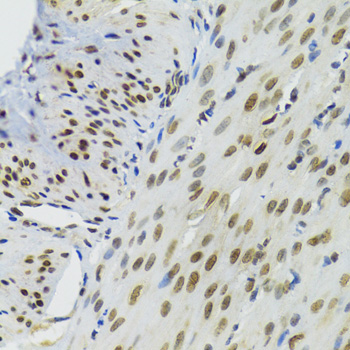 Immunohistochemistry - BAZ1B Polyclonal Antibody 