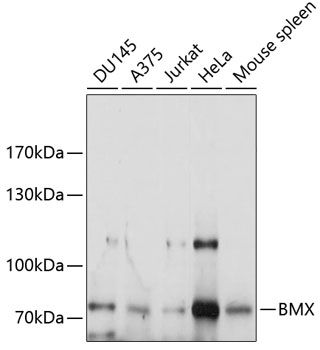 Western blot - BMX Polyclonal Antibody 