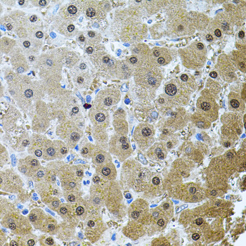 Immunohistochemistry - RNF166 Polyclonal Antibody 