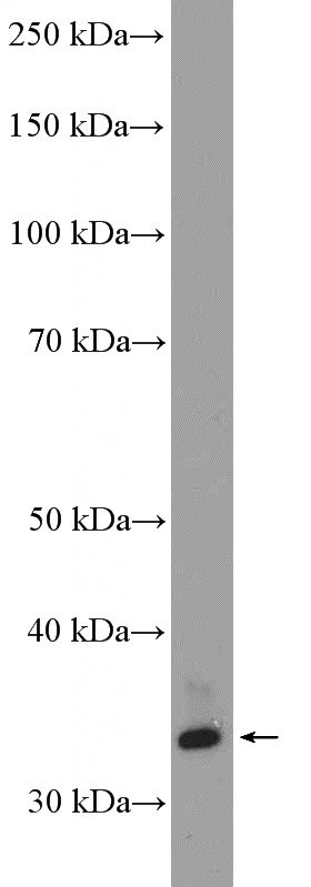 rat brain tissue were subjected to SDS PAGE followed by western blot with Catalog No:115833(SULT4A1 Antibody) at dilution of 1:600