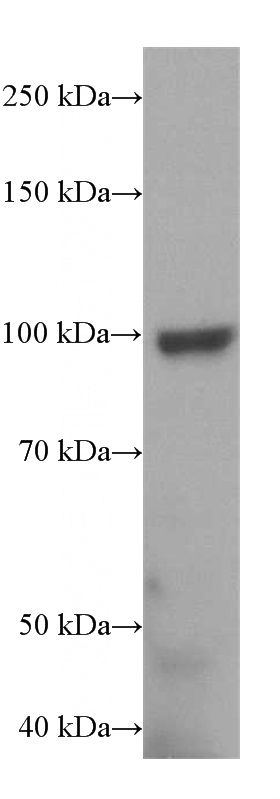 mouse brain tissue were subjected to SDS PAGE followed by western blot with Catalog No:116409(TRPC6 antibody) at dilution of 1:500