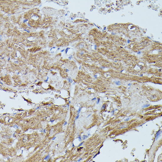 Immunohistochemistry - FLII Polyclonal Antibody 