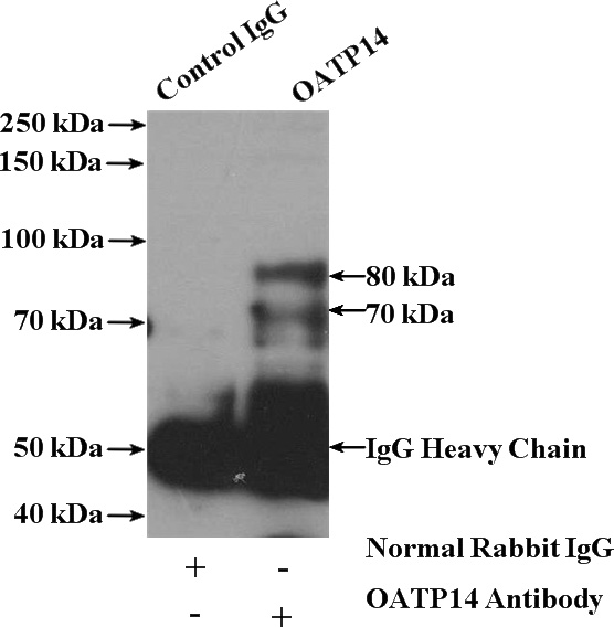 IP Result of anti-OATP14 (IP:Catalog No:113462, 4ug; Detection:Catalog No:113462 1:800) with mouse brain tissue lysate 4000ug.