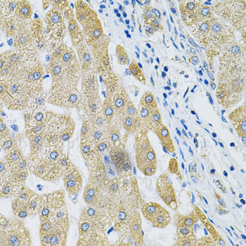 Immunohistochemistry - ALG2 Polyclonal Antibody 