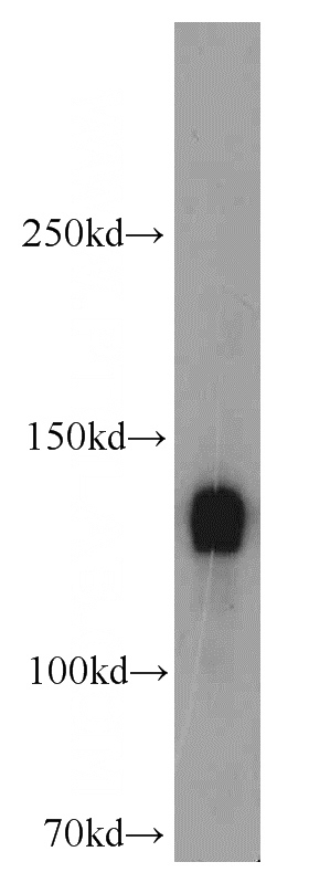 HeLa cells were subjected to SDS PAGE followed by western blot with Catalog No:113001(MYPT1 antibody) at dilution of 1:3000