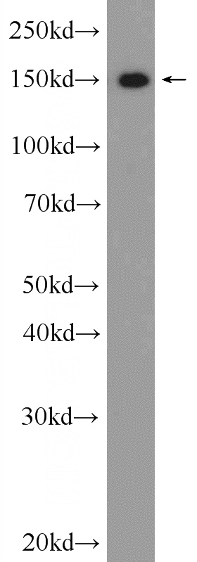 HeLa cells were subjected to SDS PAGE followed by western blot with Catalog No:116047(THoc2 Antibody) at dilution of 1:300