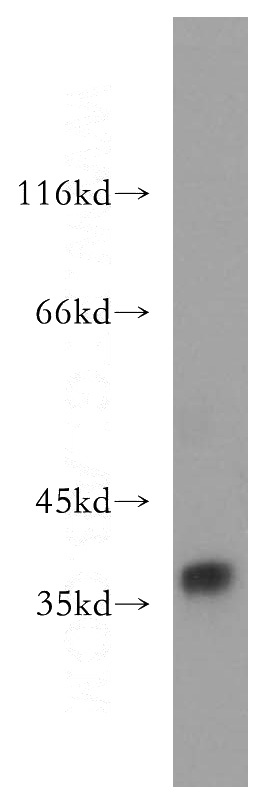 human testis tissue were subjected to SDS PAGE followed by western blot with Catalog No:110678(FKBP6 antibody) at dilution of 1:300