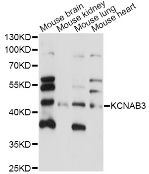 Western blot - KCNAB3 Polyclonal Antibody 