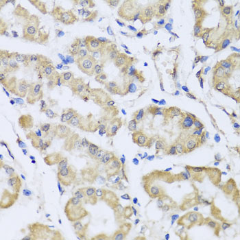 Immunohistochemistry - RCN2 Polyclonal Antibody 