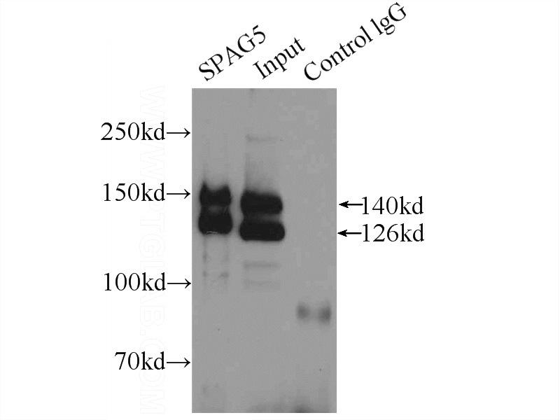IP Result of anti-SPAG5 (IP:Catalog No:115533, 5ug; Detection:Catalog No:115533 1:1000) with HeLa cells lysate 3000ug.