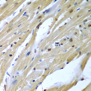Immunohistochemistry - TUSC2 Polyclonal Antibody 