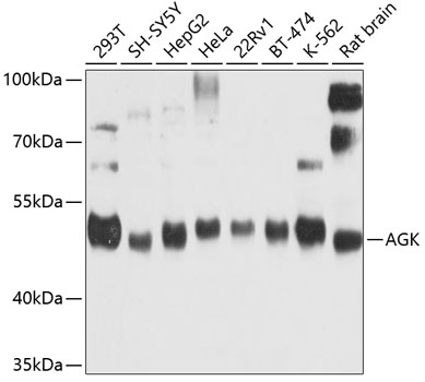 Western blot - AGK Polyclonal Antibody 