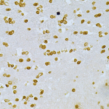 Immunohistochemistry - DKC1 Polyclonal Antibody 