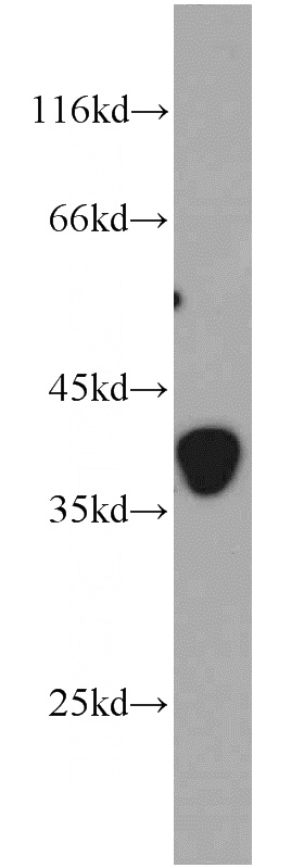 mouse brain tissue were subjected to SDS PAGE followed by western blot with Catalog No:109405(CLTA antibody) at dilution of 1:800