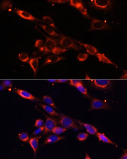 Immunofluorescence - IKBKE Polyclonal Antibody 