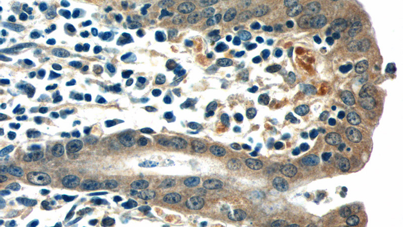Immunohistochemistry of paraffin-embedded human stomach tissue slide using Catalog No:107921(JUB Antibody) at dilution of 1:50 (under 40x lens)
