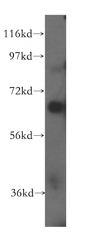 K-562 cells were subjected to SDS PAGE followed by western blot with Catalog No:109028(CD33 antibody) at dilution of 1:600