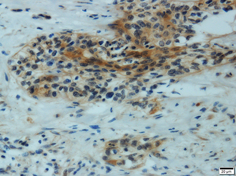 Immunohistochemistry - MMP1 Polyclonal Antibody 