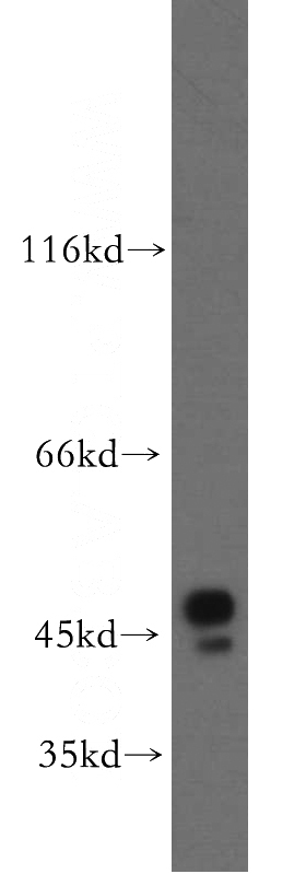 MCF7 cells were subjected to SDS PAGE followed by western blot with Catalog No:108559(BZW1 antibody) at dilution of 1:500