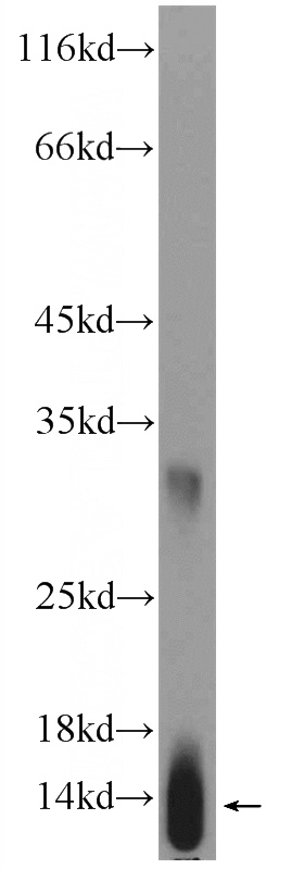 human placenta tissue were subjected to SDS PAGE followed by western blot with Catalog No:111268(HBG1 Antibody) at dilution of 1:600
