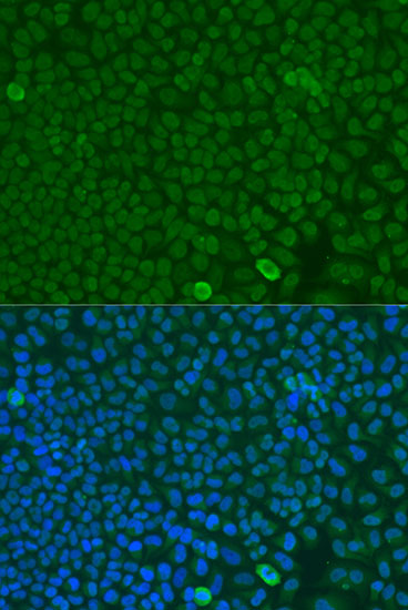 Immunofluorescence - FBXW7 Polyclonal Antibody 