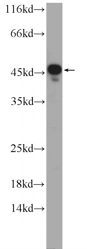 mouse liver tissue were subjected to SDS PAGE followed by western blot with Catalog No:115834(SUMF1 Antibody) at dilution of 1:1000