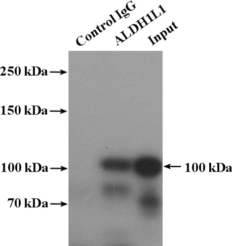 IP Result of anti-ALDH1L1 (IP:Catalog No:107964, 4ug; Detection:Catalog No:107964 1:500) with mouse liver tissue lysate 4000ug.