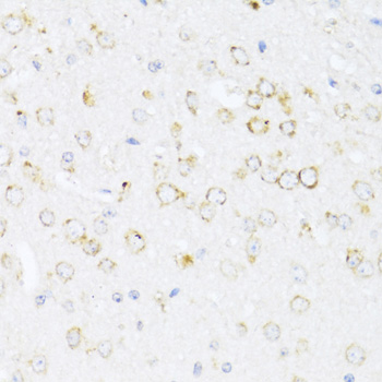 Immunohistochemistry - ALOX12 Polyclonal Antibody 