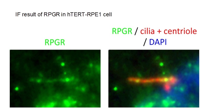 IF result of anti-RPGR(Catalog No:114803) in hTERT-RPE1 cell by Dr. Seongjin Seo.