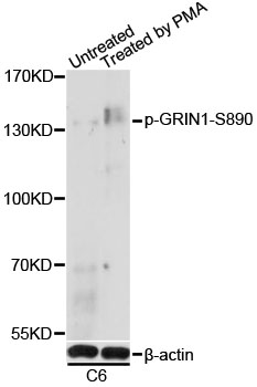Western blot - Phospho-GRIN1-S890 pAb 