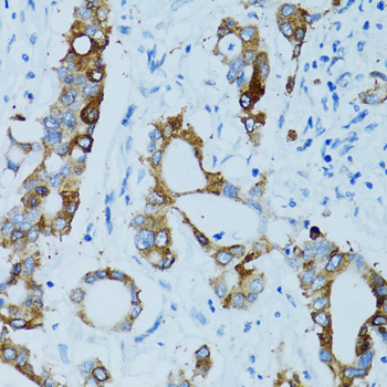 Immunohistochemistry - CTSE Polyclonal Antibody 