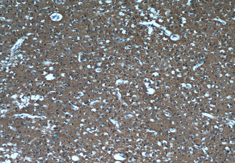 Immunohistochemistry of paraffin-embedded human brain tissue slide using Catalog No:107271(PTPRN Antibody) at dilution of 1:50 (under 10x lens)