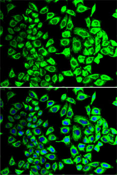 Immunofluorescence - SDHA Polyclonal Antibody 