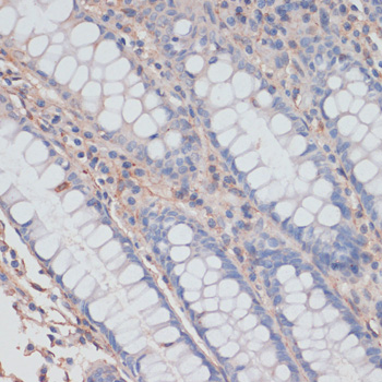 Immunohistochemistry - ZNRF3 Polyclonal Antibody 