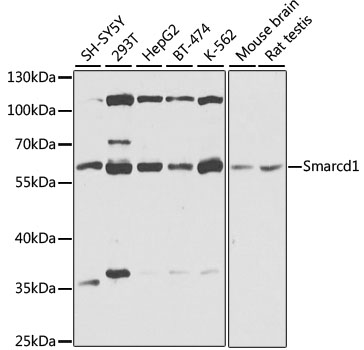 Western blot - BAF60a Polyclonal Antibody 