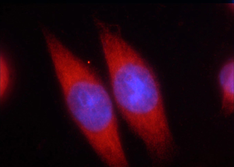 Immunofluorescent analysis of HeLa cells using Catalog No:113169(NFKB1 Antibody) at dilution of 1:50 and Rhodamine-Goat anti-Rabbit IgG