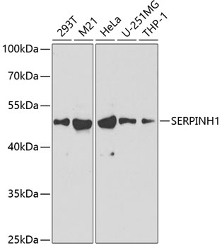 Western blot - SERPINH1 Polyclonal Antibody 