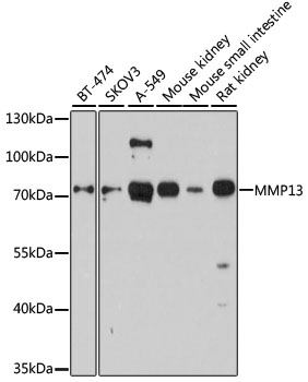 Western blot - MMP13 Polyclonal Antibody 