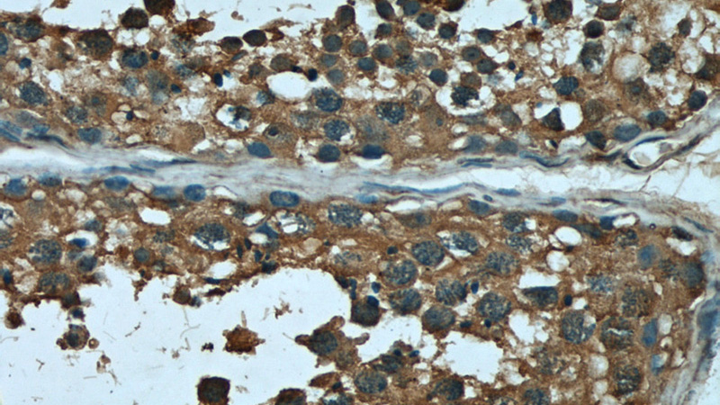 Immunohistochemical of paraffin-embedded human testis using Catalog No:107081(Bcl-xL antibody) at dilution of 1:50 (under 40x lens)