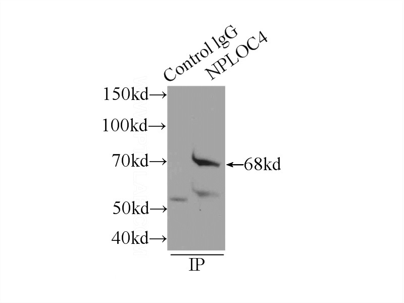 IP Result of anti-NPLoc4 (IP:Catalog No:113218, 4ug; Detection:Catalog No:113218 1:600) with mouse kidney tissue lysate 6000ug.