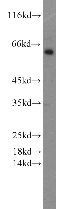 mouse liver tissue were subjected to SDS PAGE followed by western blot with Catalog No:112471(MAOB antibody) at dilution of 1:1000