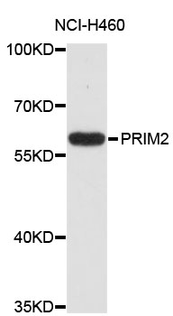 Western blot - PRIM2 Polyclonal Antibody 