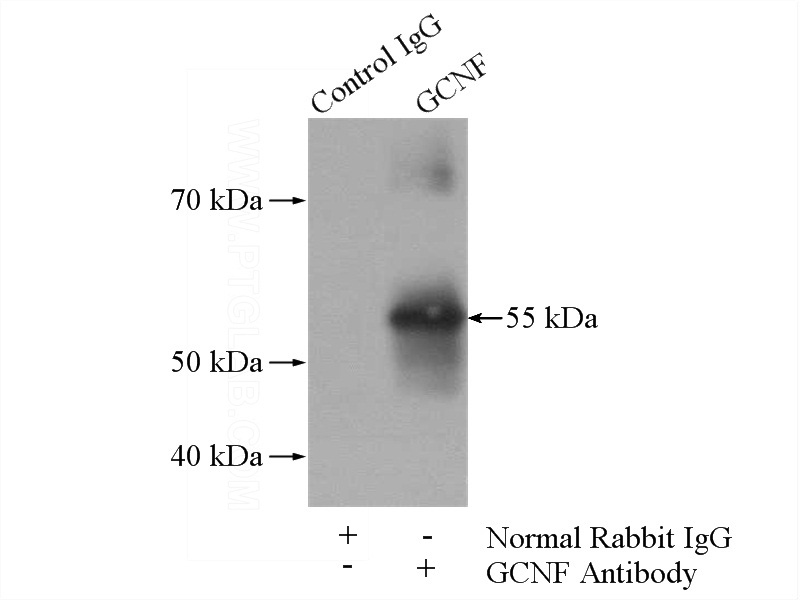 IP Result of anti-NR6A1 (IP:Catalog No:110911, 4ug; Detection:Catalog No:110911 1:800) with mouse testis tissue lysate 4000ug.