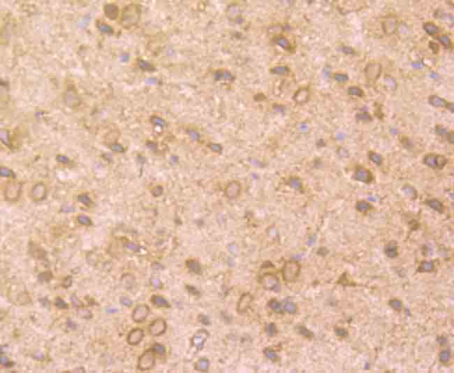 Fig6: Immunohistochemical analysis of paraffin-embedded mouse brain tissue using anti-TrkA antibody. Counter stained with hematoxylin.